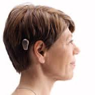 Bone Anchored Hearing