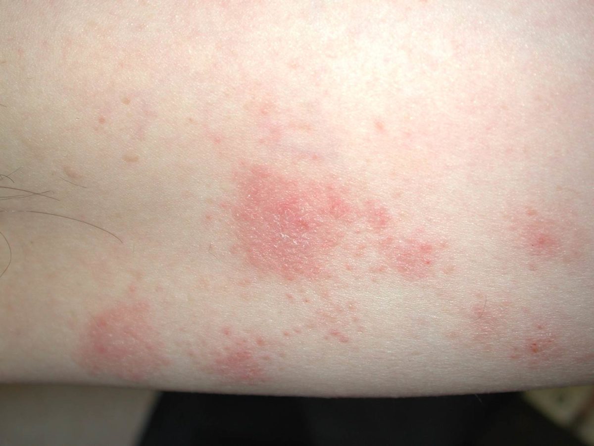 Conditions We Treat SaTH